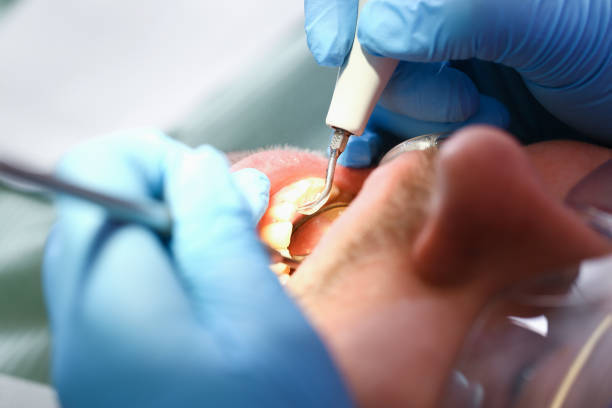 Best Walk-In Emergency Dental Services in Mascot, TN